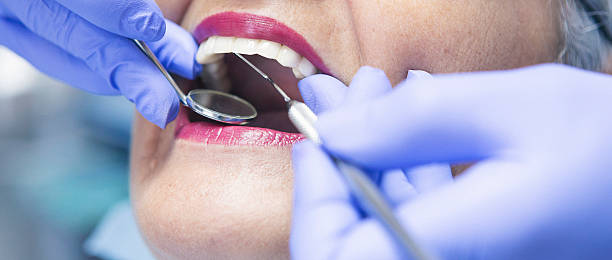 Best Emergency Dental Care for Broken or Chipped Teeth in Fort Payne, AL